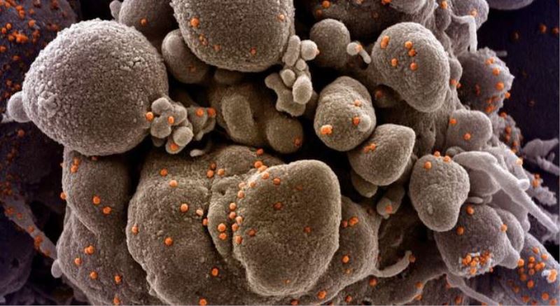 Mutasyonlu Virüs Hakkında Kritik Uyarı! Maskeden Bulaşabilir